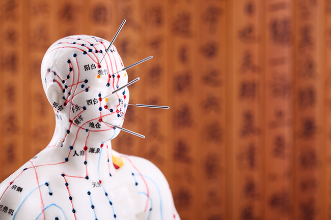 Acupuncture - img