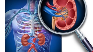 Nuclear Medicine Complete Renal (Kidney) Function Study 核醫腎功能暨尿路阻塞檢查