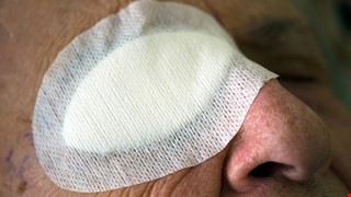 Precautions for Home Care After Eye Surgery 眼睛手術後居家護理注意事項