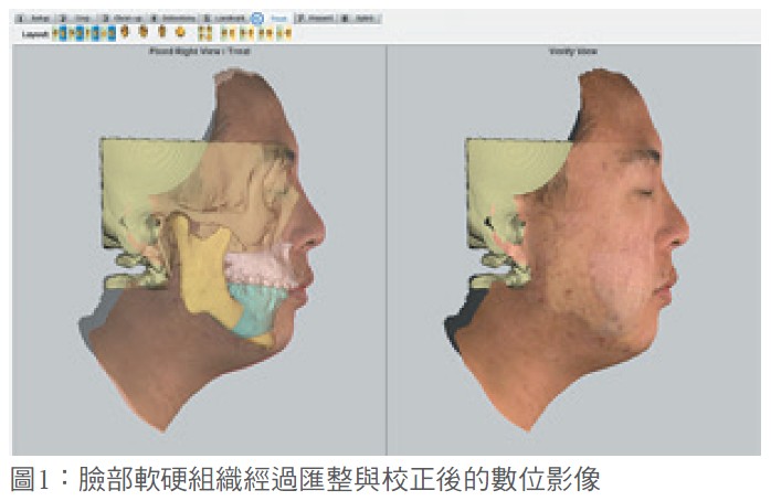 圖1：臉部軟硬組織經過匯整與校正後的數位影像