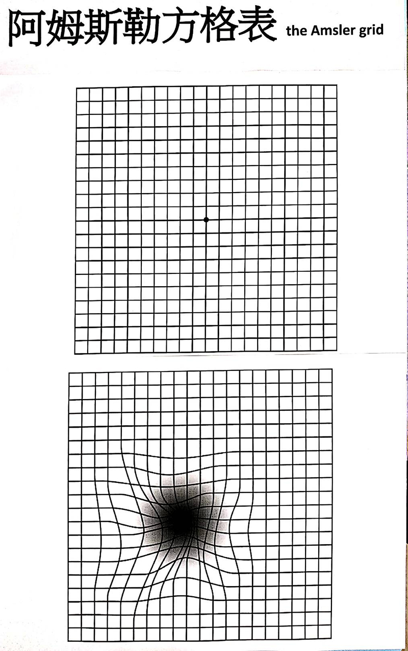 阿姆斯勒方格表